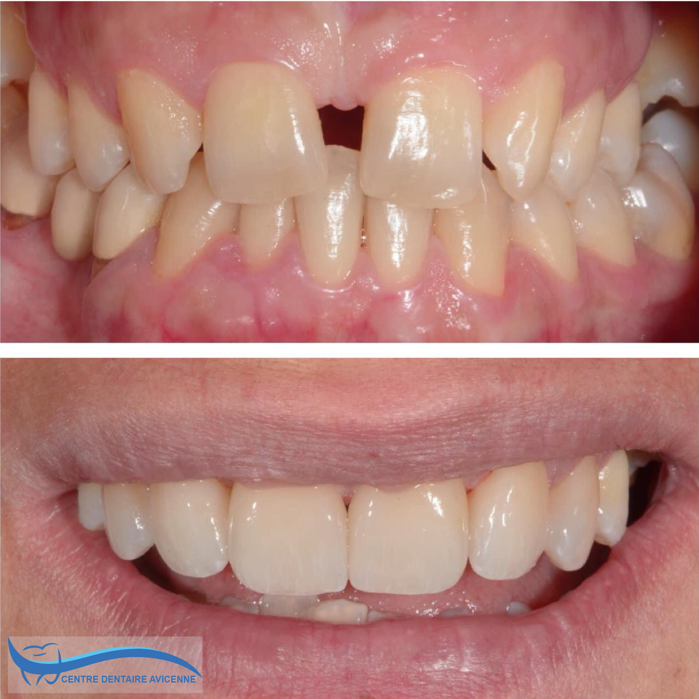 Clinic Dentaire Avicenne
