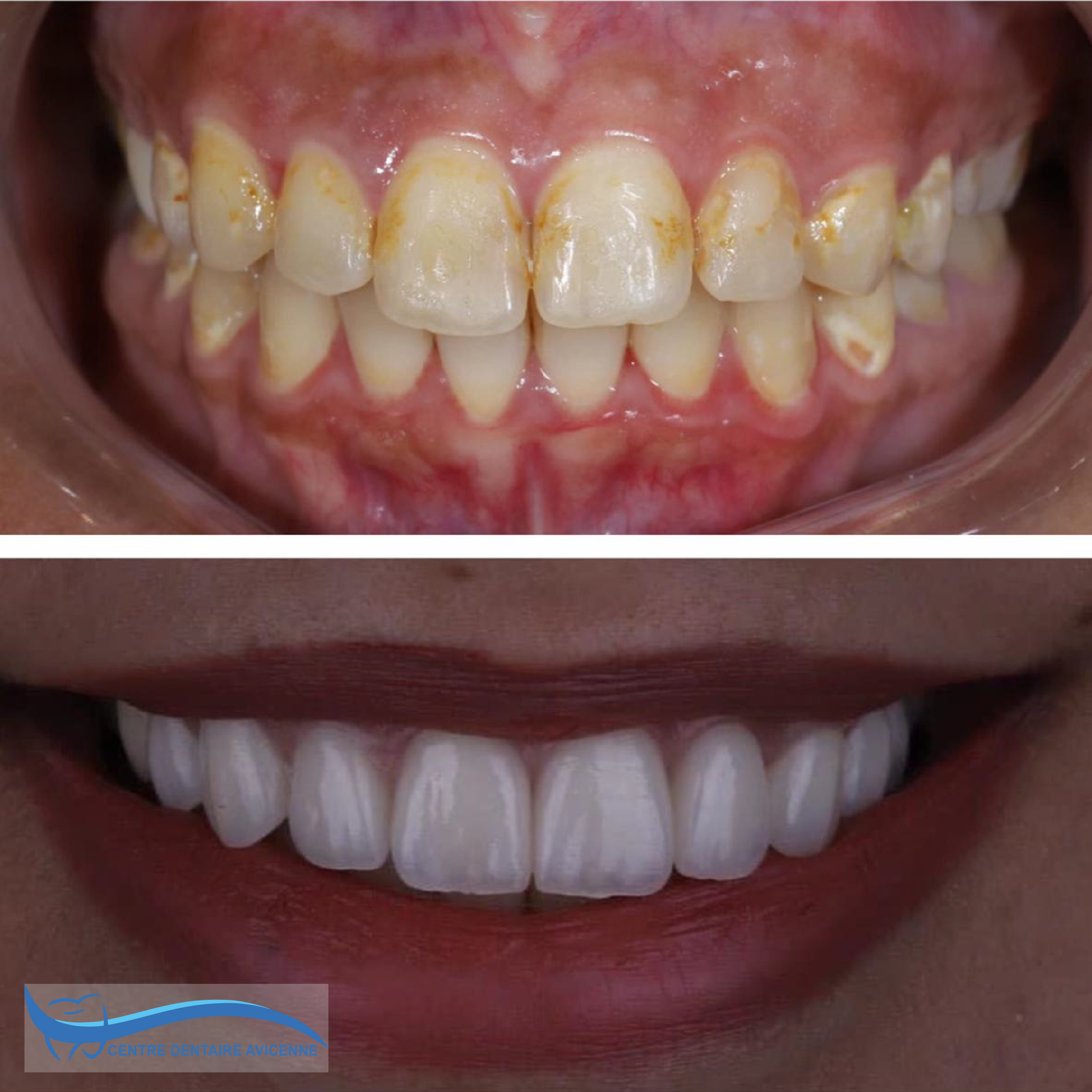 Clinic Dentaire Avicenne