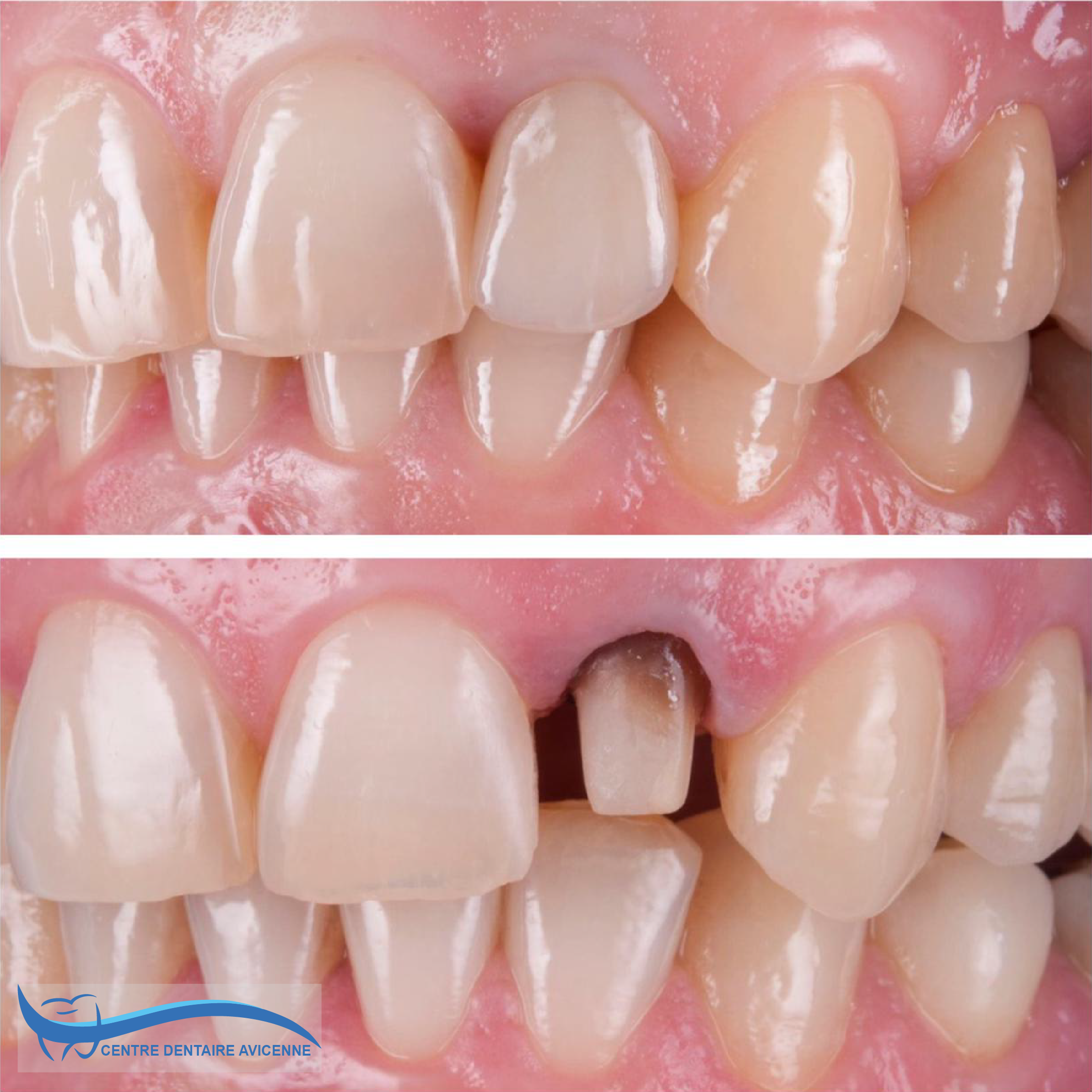 Clinic Dentaire Avicenne